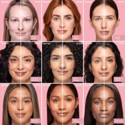 Miracle Flawless Skin Foundation -Cosmetics Store MiracleFlawlessSkinFoundationbeforeandafters 22a82488 c703 46fe 9bc2 7fbab4fa5213